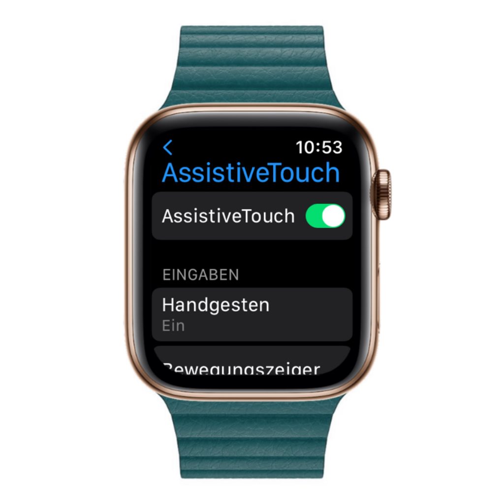 Apple Watch AssistiveTouch 