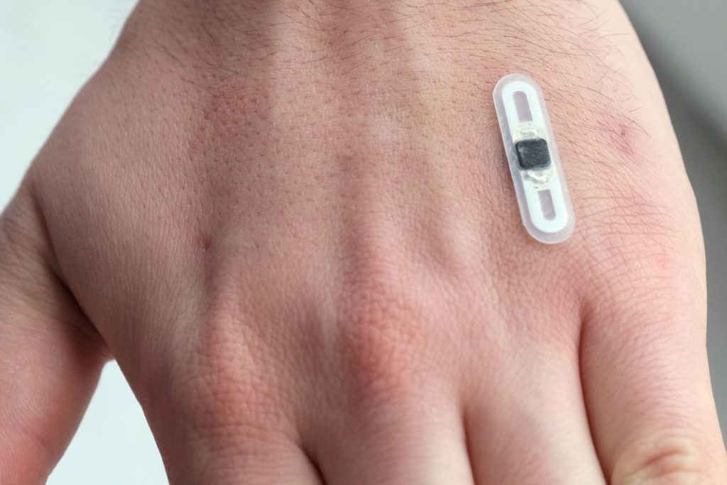 NFC Implantat auf der Hand
