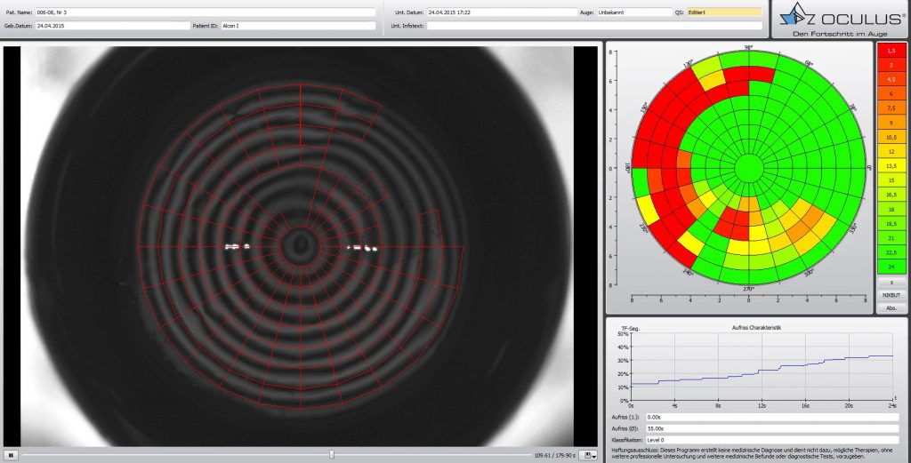 Der Screenshot zeigt eine Messung mit Kameras der Kontaktlinsen.
